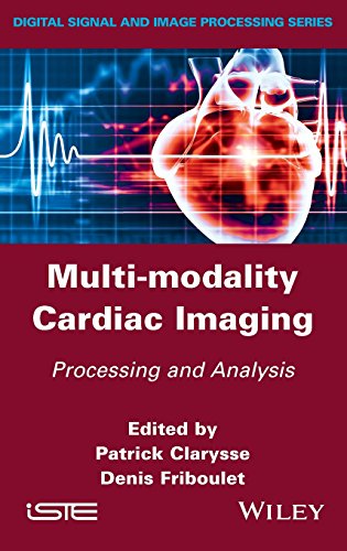 Multi-modality cardiac imaging : processing and analysis