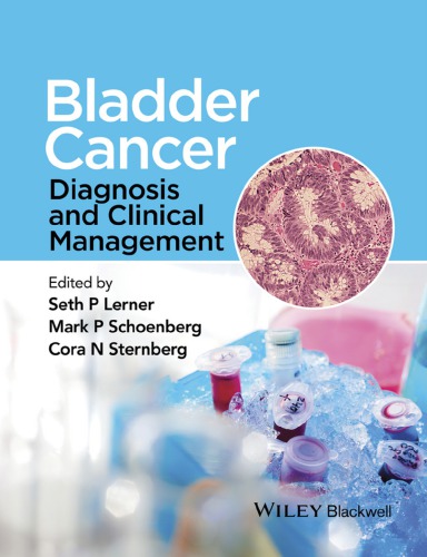 Bladder cancer : diagnosis and clinical management