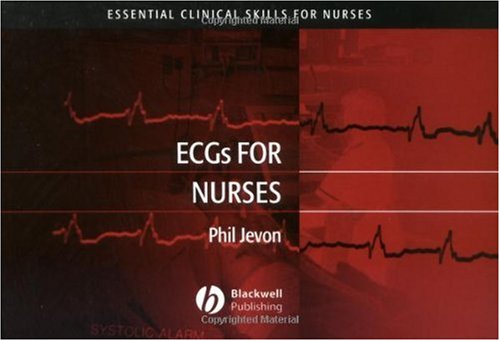 ECGs for Nurses (Essential Clinical Skills for Nurses)
