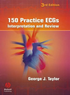 150 Practice ECGs: Interpretation and Review, Third Edition