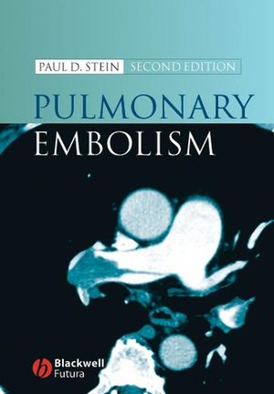 Pulmonary Embolism, Second Edition