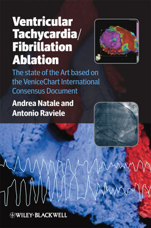 Ventricular Tachycardia/Fibrillation Ablation: The State of the Art Based on the Venicechart International Consensus Document