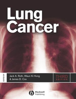 Lung Cancer, Third Edition