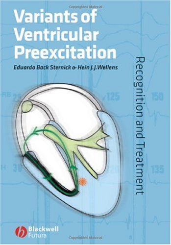 Variants of Ventricular Preexcitation: Recognition and Treatment