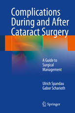 Complications During and After Cataract Surgery: A Guide to Surgical Management