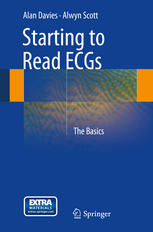 Starting to Read ECGs: The Basics