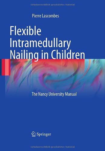 Flexible Intramedullary Nailing in Children: The Nancy University Manual