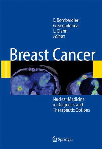 Breast Cancer Nuclear Medicine in Diagnosis and Therapeutic Options