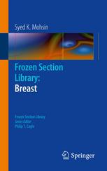 Frozen Section Library: Breast