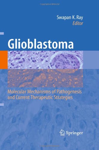 Glioblastoma: Molecular Mechanisms of Pathogenesis and Current Therapeutic Strategies