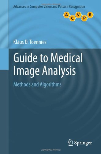 Guide to Medical Image Analysis: Methods and Algorithms