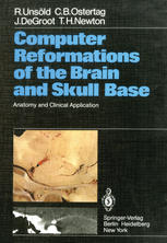 Computer Reformations of the Brain and Skull Base: Anatomy and Clinical Application