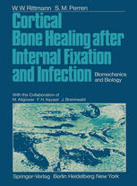 Cortical Bone Healing after Internal Fixation and Infection: Biomechanics and Biology