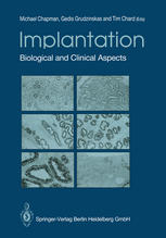 Implantation: Biological and Clinical Aspects