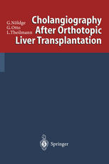 Cholangiography After Orthotopic Liver Transplantation
