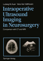 Intraoperative Ultrasound Imaging in Neurosurgery: Comparison with CT and MRI