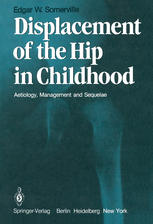 Displacement of the Hip in Childhood: Aetiology, Management and Sequelae