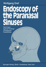Endoscopy of the Paranasal Sinuses: Technique · Typical Findings Therapeutic Possibilities
