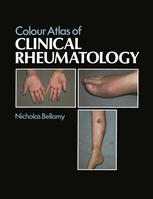 Colour Atlas of Clinical Rheumatology