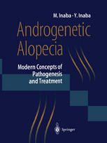 Androgenetic Alopecia: Modern Concepts of Pathogenesis and Treatment
