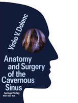 Anatomy and Surgery of the Cavernous Sinus