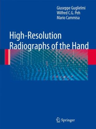 High-Resolution Radiographs of the Hand