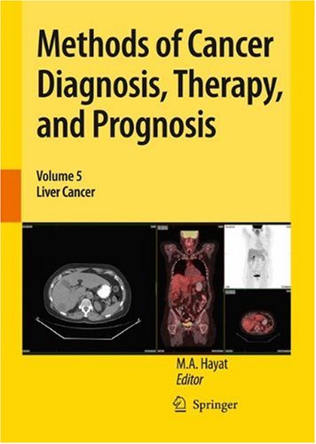 Methods of Cancer Diagnosis, Therapy, and Prognosis: Liver Cancer (Methods of Cancer Diagnosis, Therapy and Prognosis)