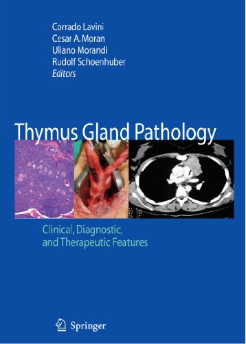 Thymus Gland Pathology: Clinical, Diagnostic and Therapeutic Features