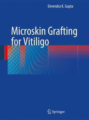Microskin Grafting for Vitiligo