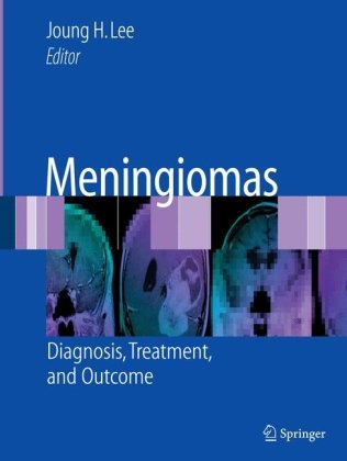 Meningiomas