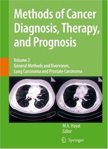 Methods of Cancer Diagnosis, Therapy and Prognosis: General Methods and Overviews, Lung Carcinoma and Prostate Carcinoma (Methods of Cancer Diagnosis,