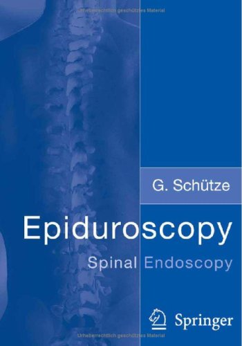 Epiduroscopy: Spinal Endoscopy