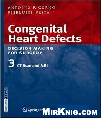 Congenital Heart Defects