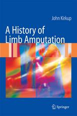 A History of Limb Amputation