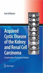 Acquired Cystic Disease of the Kidney and Renal Cell Carcinoma: Complications of Long-Term Dialysis