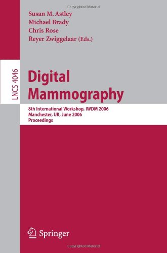 Digital Mammography: 8th International Workshop, IWDM 2006, Manchester, UK, June 18-21, 2006. Proceedings