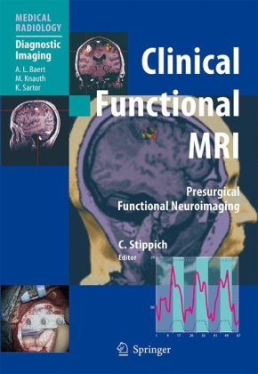 Clinical Functional MRI: Presurgical Functional Neuroimaging (Medical Radiology   Diagnostic Imaging)