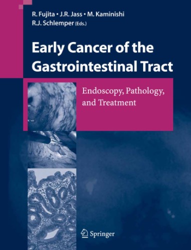 Early Cancer of the Gastrointestinal Tract / Endoscopy, Pathology, and Treatment