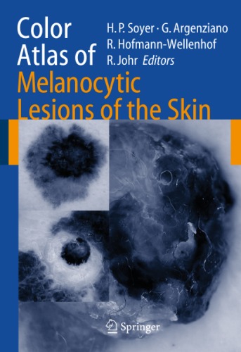 Color atlas of melanocytic lesions of the skin.