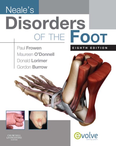Neale’s Disorders of the Foot