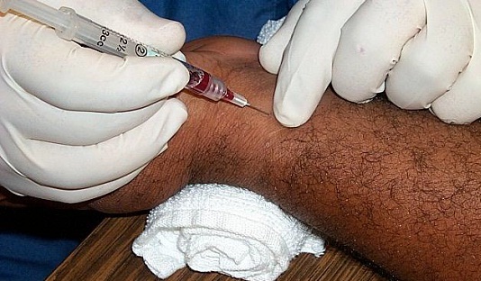 آموزش نمونه گیری از خون شریانی جهت انجام آزمایش ABG در دودقیقه