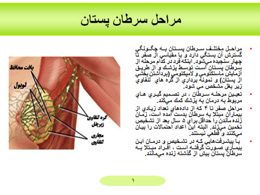 پاورپوینت مراحل سرطان پستان