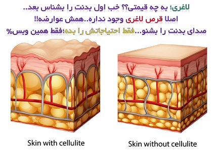 لاغری تضمینی با روش های نوین پزشکی