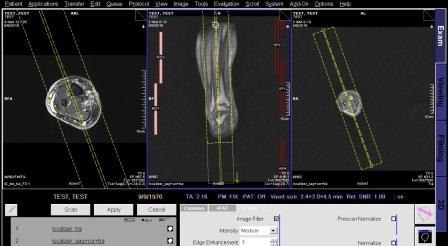 تکنیک MRI of LEG