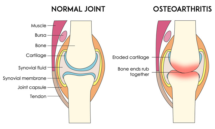 پاورپوینت کامل و جامع با عنوان بررسی غضروف و انواع آن در 13 اسلاید