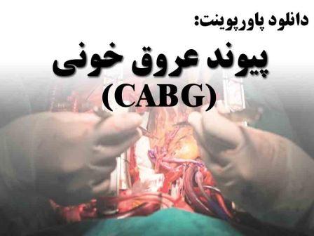 دانلود پاورپوینت پیوند عروق خونی(CABG)