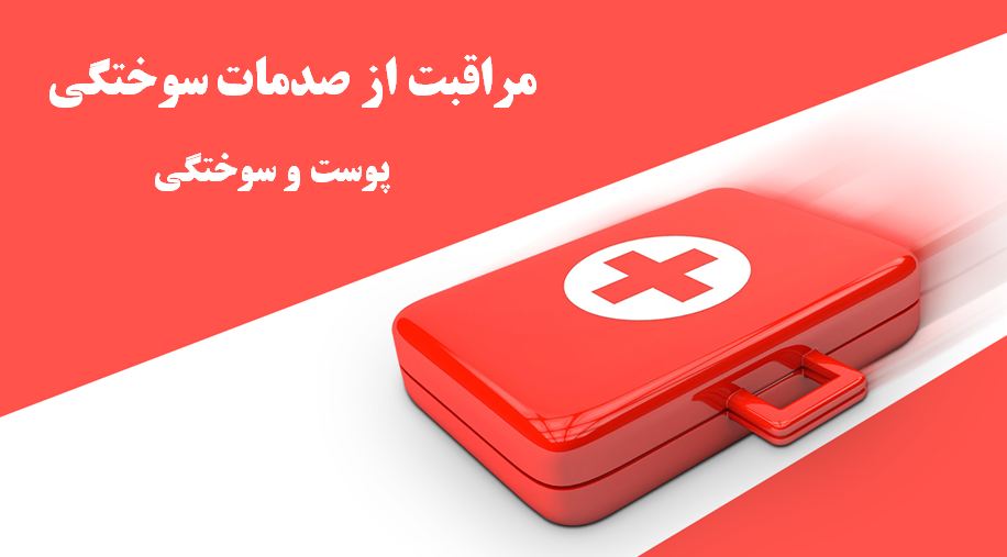 دانلود پاورپوینت مراقبت از صدمات سوختگی
