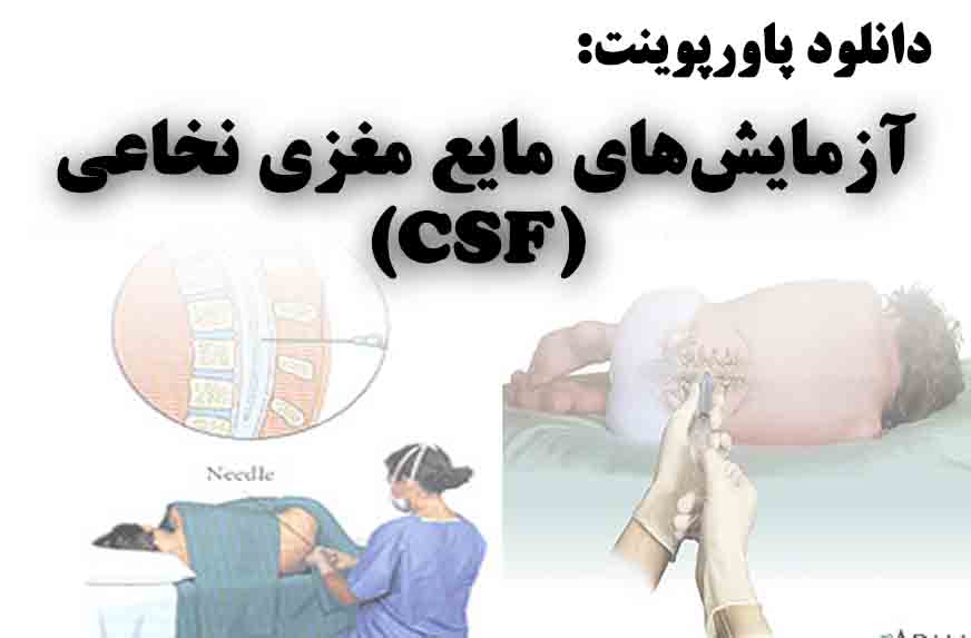 دانلود پاورپوینت آزمایش‌های مایع مغزی نخاعی(CSF)
