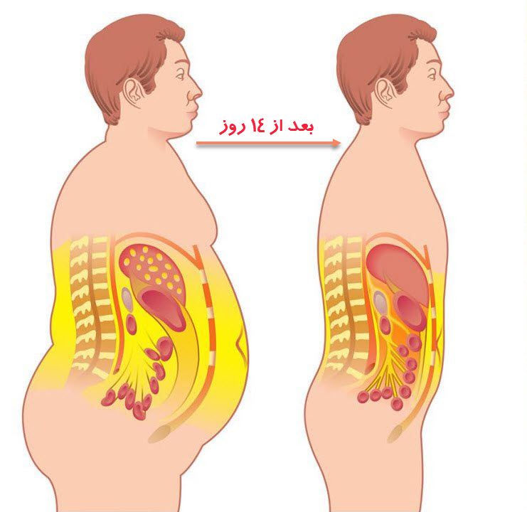 معجون شگفت انگیز برای آب کردن چربی های شکم در 14 روز