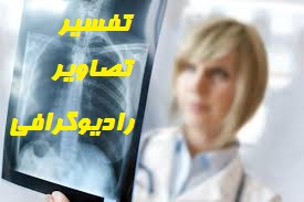 تفسیر تصاویر رادیوگرافی(PPT)